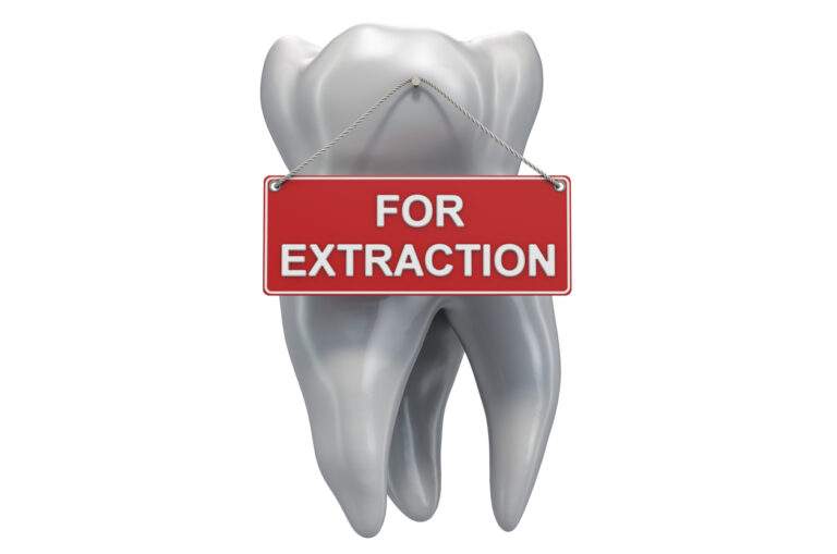 3D render of tooth with a sign that says "for extraction"