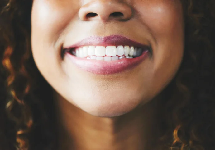 Dental Implant Trial Scams on Social Media